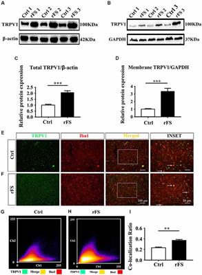 Activation of TRPV1 Contributes to Recurrent Febrile Seizures via Inhibiting the Microglial M2 Phenotype in the Immature Brain